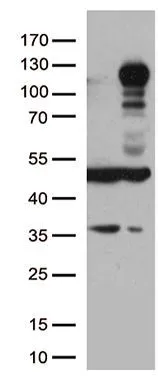 WB analysis of HEK293T cells transfected with LEMD3 plasmid (Right) or empty vector (Left) for 48 hrs using GTX84222 LEMD3 antibody [3H2]. Loading : 5 ug per lane Dilution : 1:500
