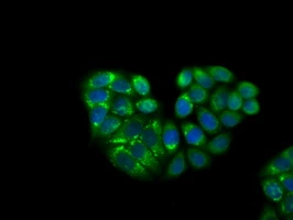 ICC/IF analysis of HeLa cells using GTX84281 KCTD5 antibody [3C8].