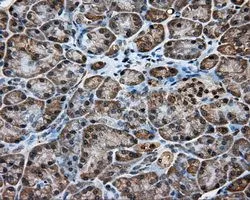 IHC-P analysis of pancreas tissue using GTX84281 KCTD5 antibody [3C8]. Antigen retrieval : Heat-induced epitope retrieval by 10mM citrate buffer, pH6.0, 100oC for 10min. Dilution : 1:50
