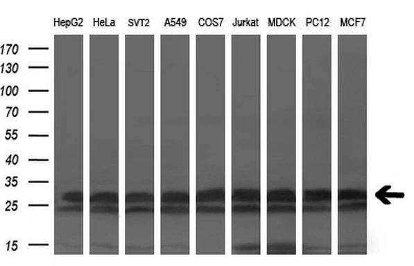 WB analysis of various cell lines using GTX84281 KCTD5 antibody [3C8]. Loading : 35 ug per lane Dilution : 1:200