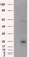 WB analysis of HEK293T cells transfected with KCTD5 plasmid (Right) or empty vector (Left) for 48 hrs using GTX84281 KCTD5 antibody [3C8]. Loading : 5 ug per lane