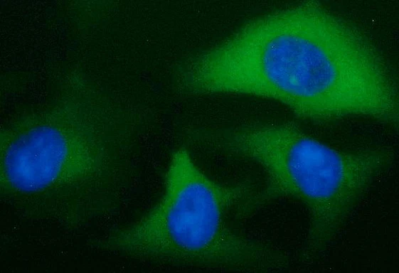 ICC/IF analysis of HeLa cells using GTX84309 IGF2BP2 antibody [4F7]. Dilution : 1:100