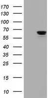 WB analysis of HEK293T cells transfected with IGF2BP2 plasmid (Right) or empty vector (Left) for 48 hrs using GTX84309 IGF2BP2 antibody [4F7]. Loading : 5 ug per lane