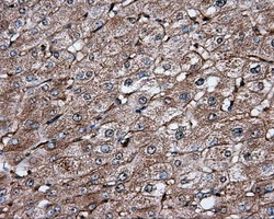 IHC-P analysis of human liver tissue using GTX84315 IFIT1 antibody [3G8]. Antigen retrieval : Heat-induced epitope retrieval by 10mM citrate buffer, pH6.0, 100oC for 10min.