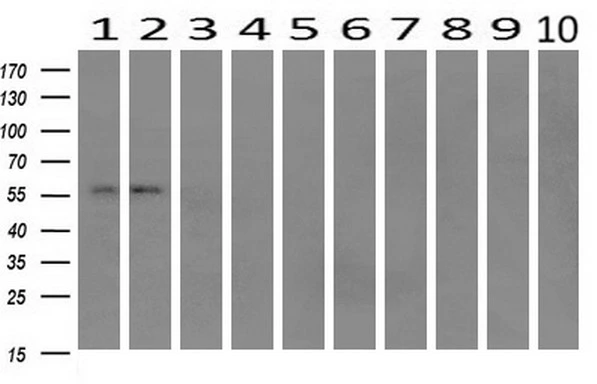 WB analysis of human tissues (Lane 1-Testis ; Lane 2-Omentum ; Lane 3-Uterus ; Lane 4-Breast ; Lane 5-Brain ; Lane 6-Liver ; Lane 7-Ovary ; Lane 8-Thyroid gland ; Lane 9-colon ; Lane 10-spleen) using GTX84315 IFIT1 antibody [3G8]. Loading : 10 ug per lane Dilution : 1:200
