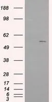 WB analysis of HEK293T cells transfected with IFIT1 plasmid (Right) or empty vector (Left) for 48 hrs using GTX84315 IFIT1 antibody [3G8]. Loading : 5 ug per lane