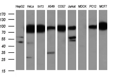 WB analysis of various cell lines using GTX84315 IFIT1 antibody [3G8]. Loading : 35 ug per lane