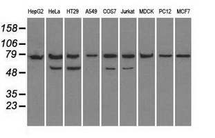 WB analysis of various cell lines using GTX84330 Grp75 antibody [4A1]. Loading : 35 ug per lane