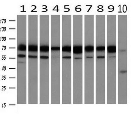 WB analysis of human tissues (Lane 1-Testis ; Lane 2-Omentum ; Lane 3-Uterus ; Lane 4-Breast ; Lane 5-Brain ; Lane 6-Liver ; Lane 7-Ovary ; Lane 8-Thyroid gland ; Lane 9-colon ; Lane 10-spleen) using GTX84330 Grp75 antibody [4A1]. Loading : 10 ug per lane Dilution : 1:500