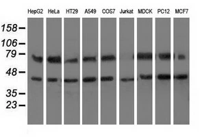 WB analysis of various cell lines using GTX84333 HSPA6 antibody [1H3]. Loading : 35 ug per lane