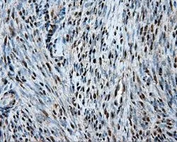 IHC-P analysis of endometrium tissue using GTX84337 Hsp70 antibody [1B2]. Antigen retrieval : Heat-induced epitope retrieval by 10mM citrate buffer, pH6.0, 100oC for 10min. Dilution : 1:50