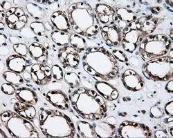 IHC-P analysis of kidney tissue using GTX84337 Hsp70 antibody [1B2]. Antigen retrieval : Heat-induced epitope retrieval by 10mM citrate buffer, pH6.0, 100oC for 10min. Dilution : 1:50