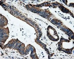 IHC-P analysis of liver tissue using GTX84337 Hsp70 antibody [1B2]. Antigen retrieval : Heat-induced epitope retrieval by 10mM citrate buffer, pH6.0, 100oC for 10min. Dilution : 1:50