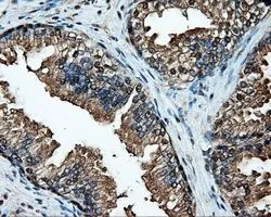 IHC-P analysis of prostate tissue using GTX84337 Hsp70 antibody [1B2]. Antigen retrieval : Heat-induced epitope retrieval by 10mM citrate buffer, pH6.0, 100oC for 10min. Dilution : 1:50