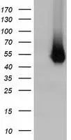 WB analysis of HEK293T cells transfected with Haptoglobin plasmid (Right) or empty vector (Left) for 48 hrs using GTX84351 Haptoglobin antibody [1B1]. Loading : 5 ug per lane