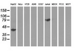 WB analysis of various cell lines using GTX84351 Haptoglobin antibody [1B1]. Loading : 35 ug per lane