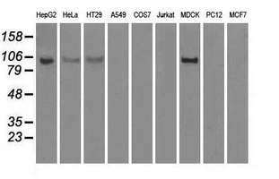 WB analysis of various cell lines using GTX84357 Hexokinase II antibody [4C5]. Loading : 35 ug per lane