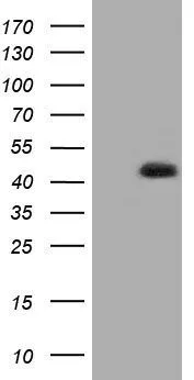 WB analysis of HEK293T cells transfected with HIBCH plasmid (Right) or empty vector (Left) for 48 hrs using GTX84362 HIBCH antibody [1C7]. Loading : 5 ug per lane