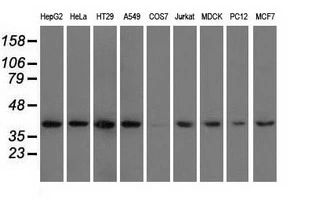 WB analysis of various cell lines using GTX84362 HIBCH antibody [1C7]. Loading : 35 ug per lane