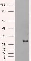 WB analysis of HEK293T cells transfected with Hex plasmid (Right) or empty vector (Left) for 48 hrs using GTX84372 Hex antibody [3C4]. Loading : 5 ug per lane