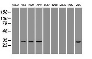 WB analysis of various cell lines using GTX84372 Hex antibody [3C4]. Loading : 35 ug per lane Dilution : 1:50