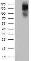 WB analysis of HEK293T cells transfected with HDAC6 plasmid (Right) or empty vector (Left) for 48 hrs using GTX84379 HDAC6 antibody [1D11]. Loading : 5 ug per lane