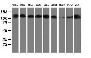 WB analysis of various cell lines using GTX84379 HDAC6 antibody [1D11]. Loading : 35 ug per lane