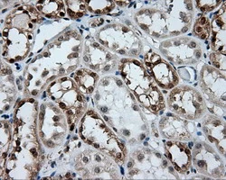 IHC-P analysis of human kidney tissue using GTX84456 GBE1 antibody [3B4]. Antigen retrieval : Heat-induced epitope retrieval by 10mM citrate buffer, pH6.0, 100oC for 10min.