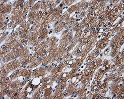IHC-P analysis of human liver tissue using GTX84456 GBE1 antibody [3B4]. Antigen retrieval : Heat-induced epitope retrieval by 10mM citrate buffer, pH6.0, 100oC for 10min.