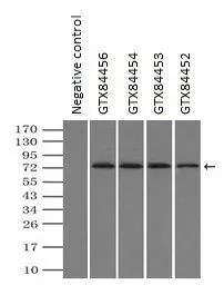 IP analysis of DDDDK tagged GBE1 overexpressed HEK293T lysate using GTX84456 GBE1 antibody [3B4].After extensive wash to remove any non-specific binding, the immuno-precipitated products were analyzed with rabbit anti-DDDDK polyclonal antibody. IP reaction : 2microg antibody / 500microl cell lysate