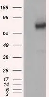 WB analysis of HEK293T cells transfected with GBE1 plasmid (Right) or empty vector (Left) for 48 hrs using GTX84456 GBE1 antibody [3B4]. Loading : 5 ug per lane