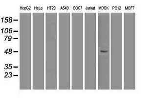 WB analysis of various cell lines using GTX84486 FOXA1 antibody [3C1]. Loading : 35 ug per lane