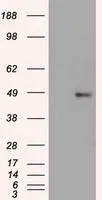 WB analysis of HEK293T cells transfected with FOXA1 plasmid (Right) or empty vector (Left) for 48 hrs using GTX84487 FOXA1 antibody [3A8]. Loading : 5 ug per lane