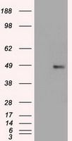 WB analysis of HEK293T cells transfected with FOXA1 plasmid (Right) or empty vector (Left) for 48 hrs using GTX84487 FOXA1 antibody [3A8]. Loading : 5 ug per lane