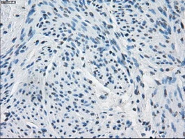 IHC-P analysis of human endometrium tissue using GTX84498 Fumarate hydratase antibody [9G4]. Antigen retrieval : Heat-induced epitope retrieval by 10mM citrate buffer, pH6.0, 100oC for 10min.