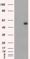 WB analysis of HEK293T cells transfected with Fumarate hydratase plasmid (Right) or empty vector (Left) for 48 hrs using GTX84498 Fumarate hydratase antibody [9G4]. Loading : 5 ug per lane