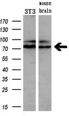 WB analysis of HEK293T cells transfected with Mig-2 plasmid (Right) or empty vector (Left) for 48 hrs using GTX84506 Mig-2 antibody [14A11]. Loading : 5 ug per lane