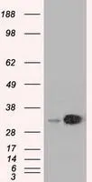 WB analysis of HEK293T cells transfected with EMG1 plasmid (Right) or empty vector (Left) for 48 hrs using GTX84576 EMG1 antibody [1B8]. Loading : 5 ug per lane