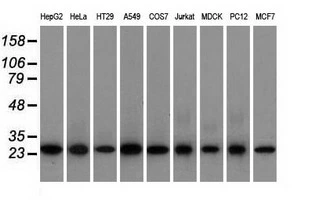 WB analysis of various cell lines using GTX84576 EMG1 antibody [1B8]. Loading : 35 ug per lane