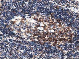 IHC-P analysis of human lymph node tissue using GTX84609 DNAJA2 antibody [3H10]. Antigen retrieval : Heat-induced epitope retrieval by 10mM citrate buffer, pH6.0, 100oC for 10min.