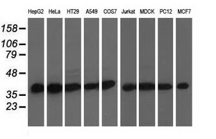WB analysis of various cell lines using GTX84609 DNAJA2 antibody [3H10]. Loading : 35 ug per lane