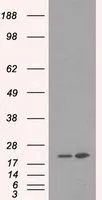 WB analysis of HEK293T cells transfected with DHFR plasmid (Right) or empty vector (Left) for 48 hrs using GTX84617 DHFR antibody [6G7]. Loading : 5 ug per lane