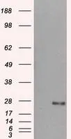 WB analysis of HEK293T cells transfected with DCXR plasmid (Right) or empty vector (Left) for 48 hrs using GTX84623 DCXR antibody [4D11]. Loading : 5 ug per lane