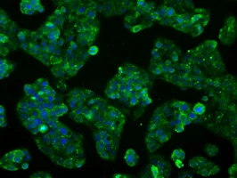 ICC/IF analysis of HepG2 cells using GTX84636 CYP2E1 antibody [5B9].