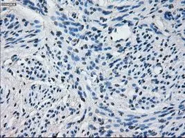 IHC-P analysis of endometrium tissue using GTX84636 CYP2E1 antibody [5B9]. Antigen retrieval : Heat-induced epitope retrieval by 10mM citrate buffer, pH6.0, 100oC for 10min. Dilution : 1:50