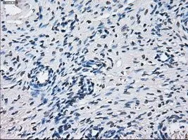 IHC-P analysis of ovary tissue using GTX84636 CYP2E1 antibody [5B9]. Antigen retrieval : Heat-induced epitope retrieval by 10mM citrate buffer, pH6.0, 100oC for 10min. Dilution : 1:50