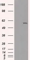 WB analysis of HEK293T cells transfected with CYP2E1 plasmid (Right) or empty vector (Left) for 48 hrs using GTX84636 CYP2E1 antibody [5B9]. Loading : 5 ug per lane