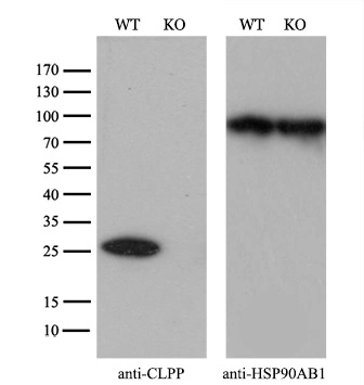 WB analysis of HEK293T cells transfected with CLPP plasmid (Right) or empty vector (Left) for 48 hrs using GTX84679 CLPP antibody [1D8]. Loading : 5 ug per lane