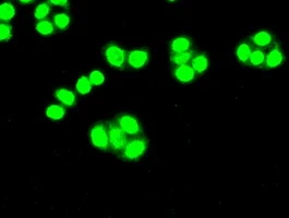 ICC/IF analysis of HT29 cells using GTX84696 CDK5 antibody [2H6].