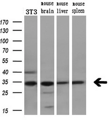 WB analysis of various samples using GTX84696 CDK5 antibody [2H6]. Loading : 10 ug per lane Dilution : 1:200